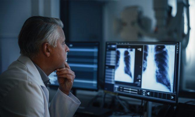 Increasing Early Detection of Lung Cancer Through Incidental Pulmonary Nodule Monitoring